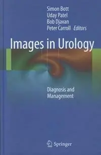 Populair Images in Urology Diagnosis and Management - Simon Bott - Uday Patel - Libro in lingua inglese - Springer London Ltd -