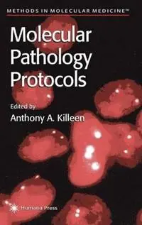 Tijdelijk Beschikbaar Molecular Pathology Protocols - Anthony A. Killeen - Libro in lingua inglese - Humana Press Inc. - Methods in Molecular Medicine